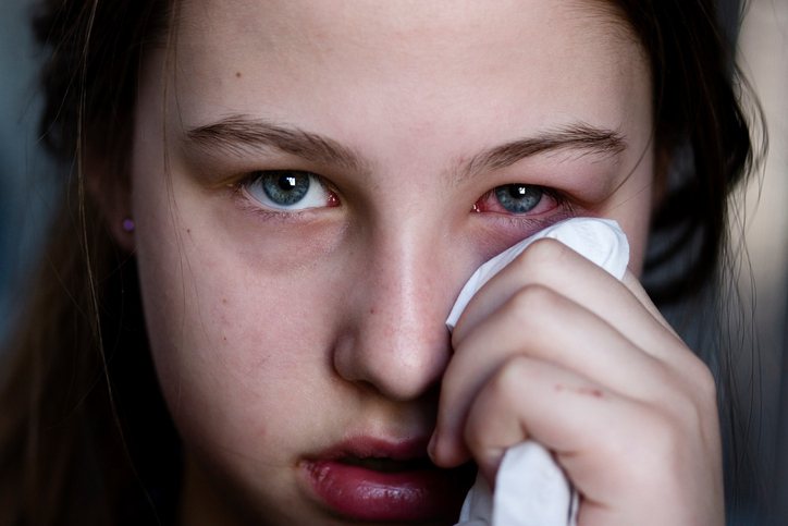 Het oog van het meisje is gezwollen en pijnlijk, mogelijk een allergie